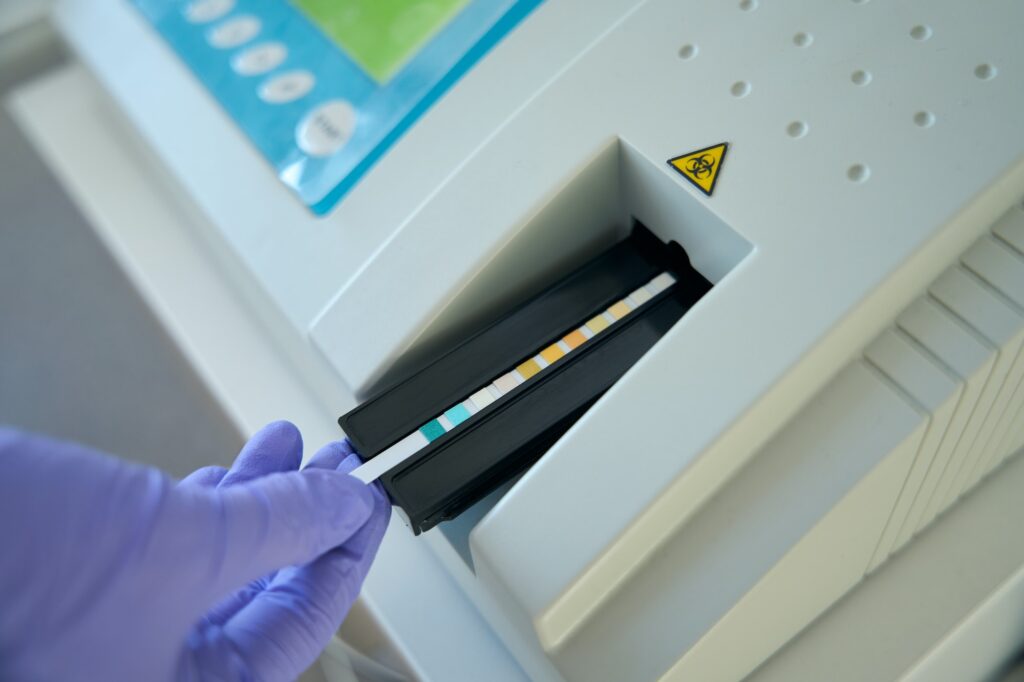 Laboratory assistant applies a test strip to a urine analyzer